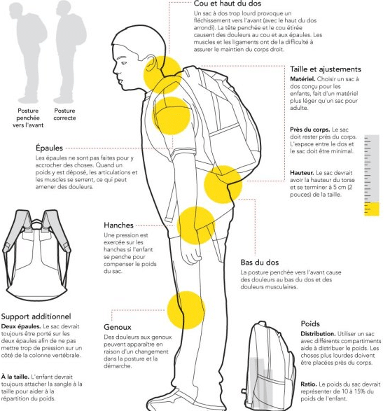 Mal de Dos chez l’enfant : attention au sac à dos